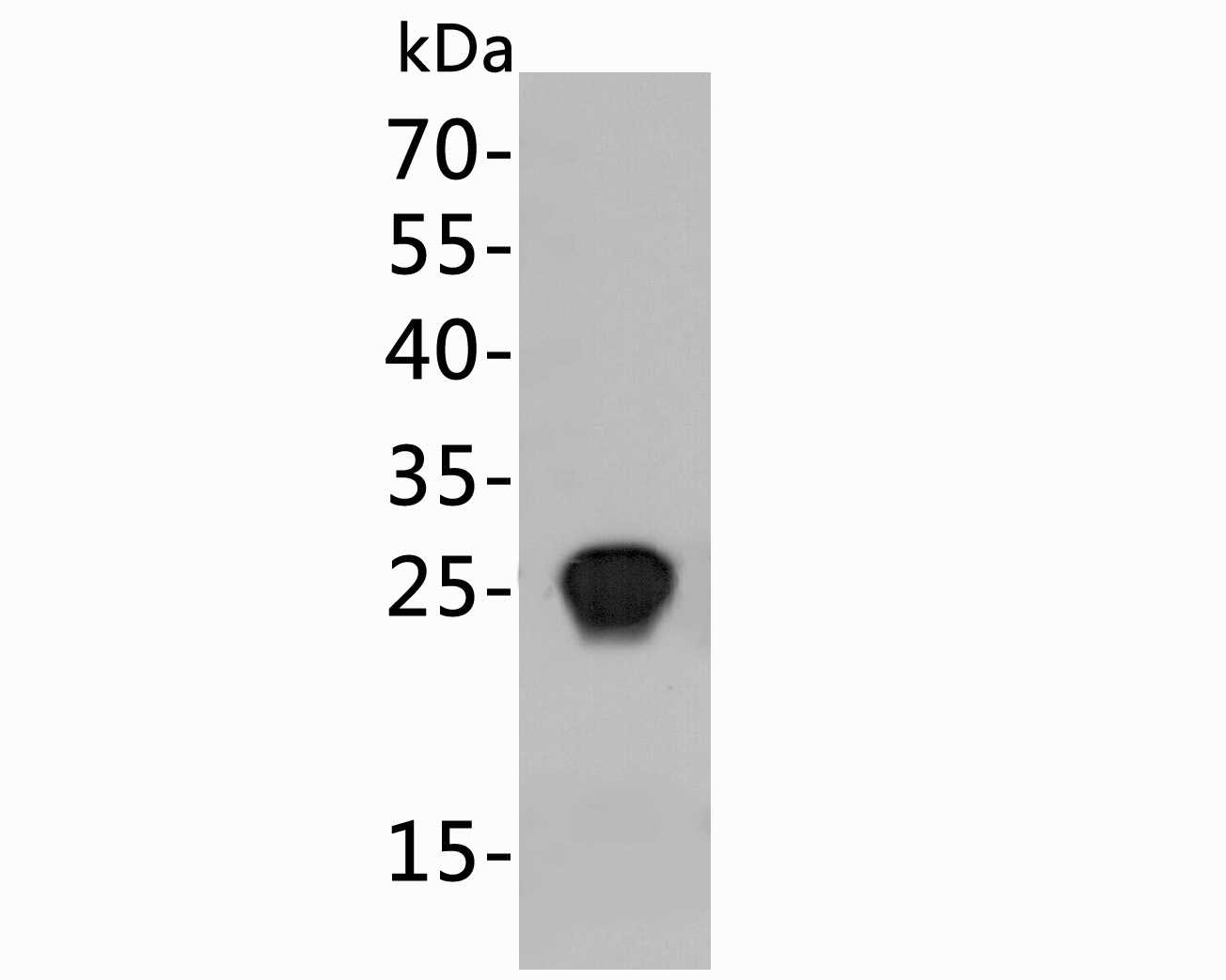 Western blot using anti-HIV1 p24 protein antibody shows detection of a 25 kDa band corresponding to Recombanint HIV1 p24 protein.