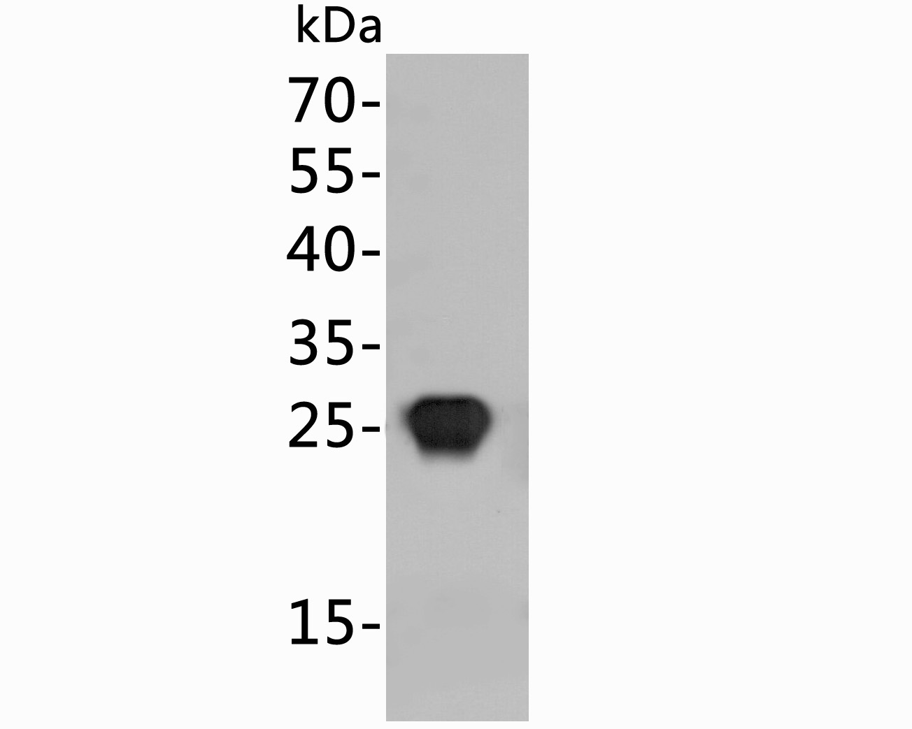Western blot using anti-HIV1 p24 protein antibody shows detection of a 25 kDa band corresponding to Recombanint HIV1 p24 protein.