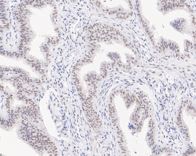 Immunohistochemical analysis of paraffin-embedded human placenta tissue using anti-HIF-1 beta antibody. The section was pre-treated using heat mediated antigen retrieval with sodium citrate buffer (pH 6.0) for 20 minutes. The tissues were blocked in 5% BSA for 30 minutes at room temperature, washed with ddH2O and PBS, and then probed with the primary antibody (ET1609-67, 1/50)  for 30 minutes at room temperature. The detection was performed using an HRP conjugated compact polymer system. DAB was used as the chromogen. Tissues were counterstained with hematoxylin and mounted with DPX.