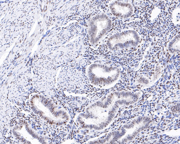 Immunohistochemical analysis of paraffin-embedded human uterus tissue using anti-HIF-1 beta antibody. The section was pre-treated using heat mediated antigen retrieval with sodium citrate buffer (pH 6.0) for 20 minutes. The tissues were blocked in 5% BSA for 30 minutes at room temperature, washed with ddH2O and PBS, and then probed with the primary antibody (ET1609-67, 1/200)  for 30 minutes at room temperature. The detection was performed using an HRP conjugated compact polymer system. DAB was used as the chromogen. Tissues were counterstained with hematoxylin and mounted with DPX.