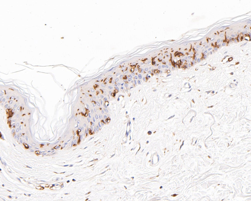 Immunohistochemical analysis of paraffin-embedded human skin tissue using anti-CD1A antibody. The section was pre-treated using heat mediated antigen retrieval with Tris-EDTA buffer (pH 8.0-8.4) for 20 minutes.The tissues were blocked in 5% BSA for 30 minutes at room temperature, washed with ddH2O and PBS, and then probed with the primary antibody (HA600031, 1/400) for 30 minutes at room temperature. The detection was performed using an HRP conjugated compact polymer system. DAB was used as the chromogen. Tissues were counterstained with hematoxylin and mounted with DPX.