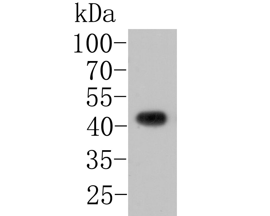 Western blot analysis of JNK2 on MCF-7 cell lysate. Proteins were transferred to a PVDF membrane and blocked with 5% BSA in PBS for 1 hour at room temperature. The primary antibody (HA500110, 1/500) was used in 5% BSA at room temperature for 2 hours. Goat Anti-Rabbit IgG - HRP Secondary Antibody (HA1001) at 1:5,000 dilution was used for 1 hour at room temperature.