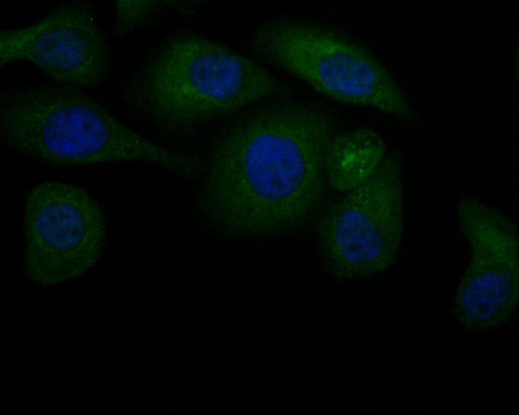 ICC staining of JNK2 in SK-OV-3 cells (green). Formalin fixed cells were permeabilized with 0.1% Triton X-100 in TBS for 10 minutes at room temperature and blocked with 1% Blocker BSA for 15 minutes at room temperature. Cells were probed with the primary antibody (HA500110, 1/200) for 1 hour at room temperature, washed with PBS. Alexa Fluor®488 Goat anti-Rabbit IgG was used as the secondary antibody at 1/1,000 dilution. The nuclear counter stain is DAPI (blue).