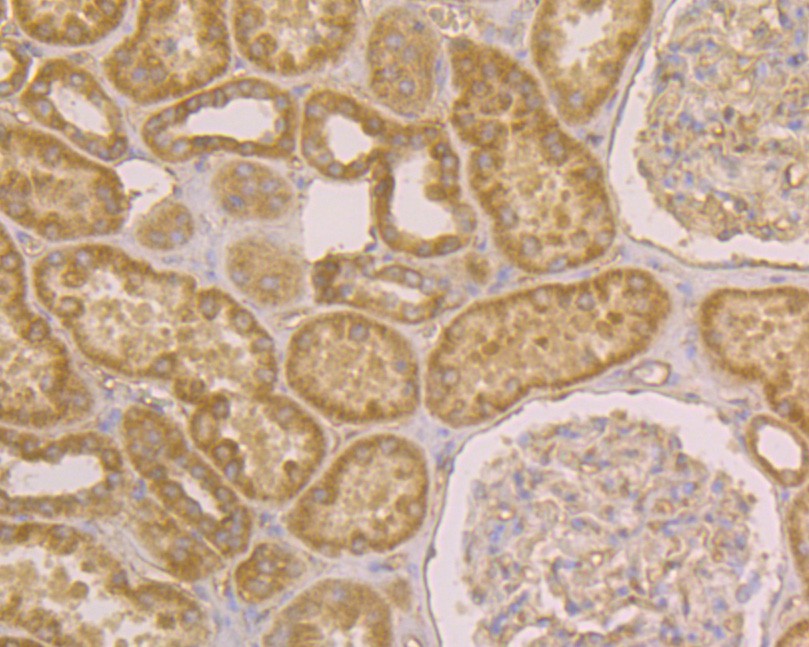 Immunohistochemical analysis of paraffin-embedded human kidney tissue using anti-JNK2 antibody. The section was pre-treated using heat mediated antigen retrieval with sodium citrate buffer (pH 6.0) for 20 minutes. The tissues were blocked in 5% BSA for 30 minutes at room temperature, washed with ddH2O and PBS, and then probed with the primary antibody (HA500110, 1/200)  for 30 minutes at room temperature. The detection was performed using an HRP conjugated compact polymer system. DAB was used as the chromogen. Tissues were counterstained with hematoxylin and mounted with DPX.