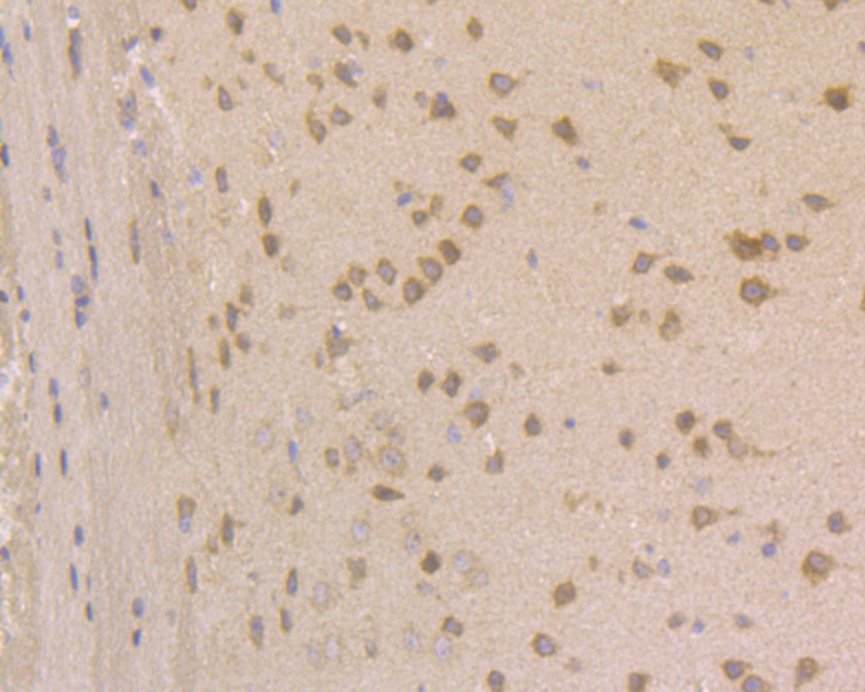 Immunohistochemical analysis of paraffin-embedded mouse brain tissue using anti-JNK2 antibody. The section was pre-treated using heat mediated antigen retrieval with sodium citrate buffer (pH 6.0) for 20 minutes. The tissues were blocked in 5% BSA for 30 minutes at room temperature, washed with ddH2O and PBS, and then probed with the primary antibody (HA500110, 1/200)  for 30 minutes at room temperature. The detection was performed using an HRP conjugated compact polymer system. DAB was used as the chromogen. Tissues were counterstained with hematoxylin and mounted with DPX.