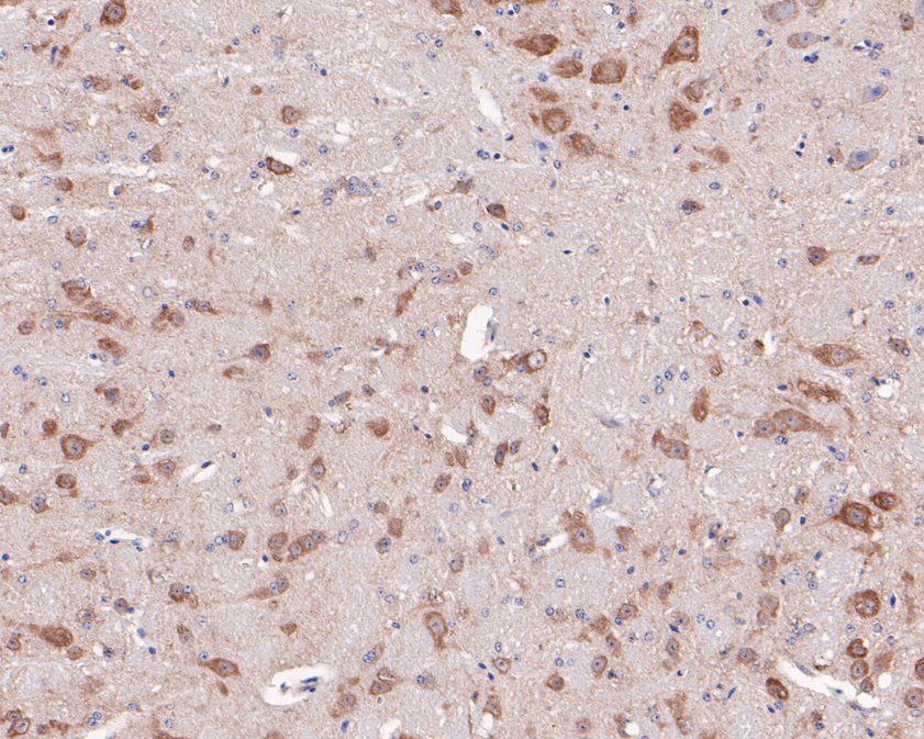 Immunohistochemical analysis of paraffin-embedded mouse brain tissue with Rabbit anti-CaMKII alpha antibody (ET1703-54) at 1/200 dilution.<br />
<br />
The section was pre-treated using heat mediated antigen retrieval with Tris-EDTA buffer (pH 9.0) for 20 minutes. The tissues were blocked in 1% BSA for 20 minutes at room temperature, washed with ddH2O and PBS, and then probed with the primary antibody (ET1703-54) at 1/200 dilution for 1 hour at room temperature. The detection was performed using an HRP conjugated compact polymer system. DAB was used as the chromogen. Tissues were counterstained with hematoxylin and mounted with DPX.