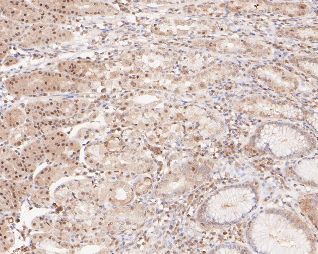 Immunohistochemical analysis of paraffin-embedded human stomach tissue using anti-ONECUT3 antibody. The section was pre-treated using heat mediated antigen retrieval with sodium citrate buffer (pH 6.0) for 20 minutes. The tissues were blocked in 5% BSA for 30 minutes at room temperature, washed with ddH2O and PBS, and then probed with the primary antibody (HA500130, 1/400)  for 30 minutes at room temperature. The detection was performed using an HRP conjugated compact polymer system. DAB was used as the chromogen. Tissues were counterstained with hematoxylin and mounted with DPX.