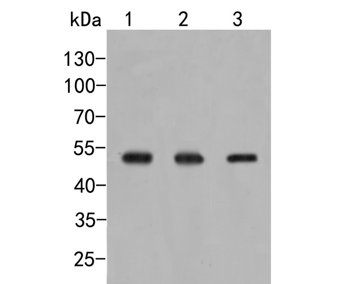 Western blot analysis of GXYLT1 on different lysates. Proteins were transferred to a PVDF membrane and blocked with 5% BSA in PBS for 1 hour at room temperature. The primary antibody (HA500113, 1/500) was used in 5% BSA at room temperature for 2 hours. Goat Anti-Rabbit IgG - HRP Secondary Antibody (HA1001) at 1:5,000 dilution was used for 1 hour at room temperature.<br />
Positive control: <br />
Lane 1: U937 cell lysate<br />
Lane 2: HL-60 cell lysate<br />
Lane 3: HUVEC cell lysate