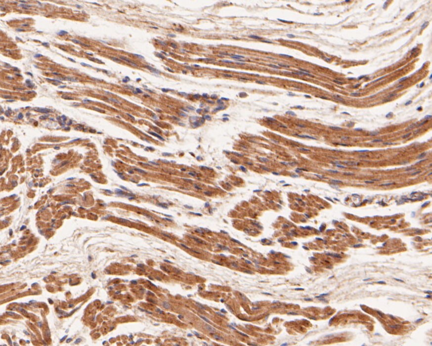 Immunohistochemical analysis of paraffin-embedded human  fetal skeletal muscle tissue using anti-GXYLT1 antibody. The section was pre-treated using heat mediated antigen retrieval with Tris-EDTA buffer (pH 8.0-8.4) for 20 minutes.The tissues were blocked in 5% BSA for 30 minutes at room temperature, washed with ddH2O and PBS, and then probed with the primary antibody (HA500113, 1/100) for 30 minutes at room temperature. The detection was performed using an HRP conjugated compact polymer system. DAB was used as the chromogen. Tissues were counterstained with hematoxylin and mounted with DPX.