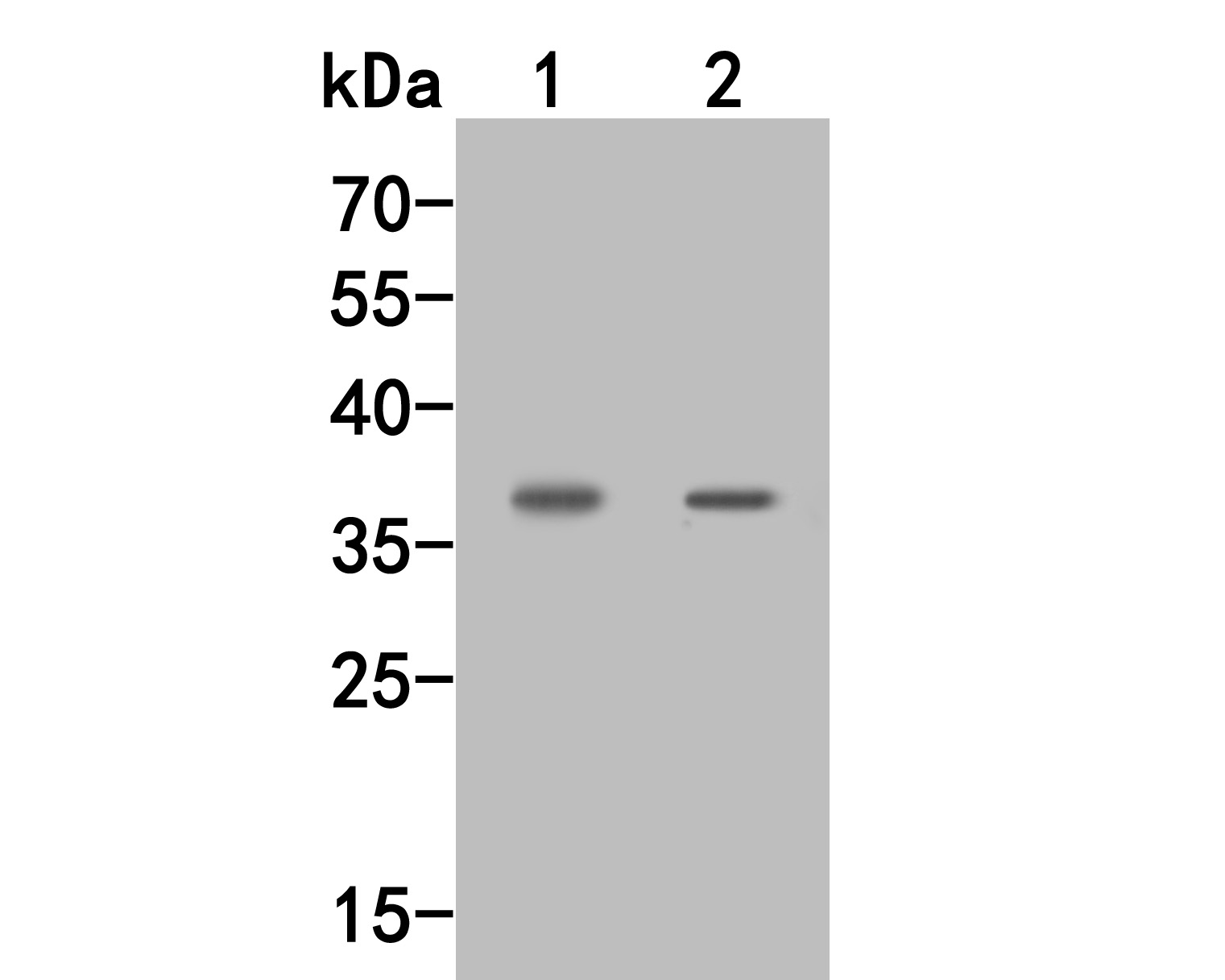 Western blot analysis of IL-2 receptor alpha on different lysates. Proteins were transferred to a PVDF membrane and blocked with 5% BSA in PBS for 1 hour at room temperature. The primary antibody (HA500076, 1/500) was used in 5% BSA at room temperature for 2 hours. Goat Anti-Rabbit IgG - HRP Secondary Antibody (HA1001) at 1:5,000 dilution was used for 1 hour at room temperature.<br />
Positive control: <br />
Lane 1: Human kidney tissue lysate<br />
Lane 2: Rat spleen tissue lysate
