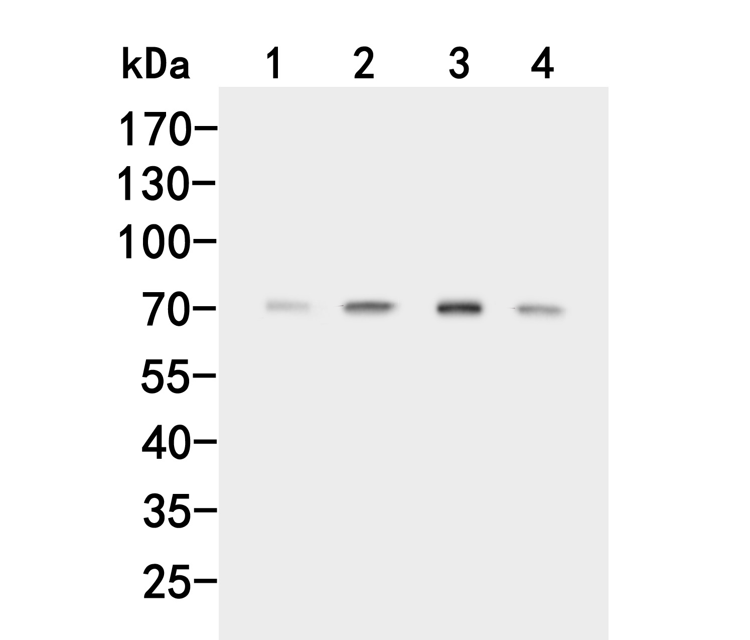 Western blot analysis of ACVR2A on different lysates. Proteins were transferred to a PVDF membrane and blocked with 5% BSA in PBS for 1 hour at room temperature. The primary antibody (HA500084, 1/500) was used in 5% BSA at room temperature for 2 hours. Goat Anti-Rabbit IgG - HRP Secondary Antibody (HA1001) at 1:200,000 dilution was used for 1 hour at room temperature.<br />
Positive control: <br />
Lane 1: SW480 cell lysate<br />
Lane 2: K562 cell lysate<br />
Lane 3: HepG2 cell lysate<br />
Lane 4: Mouse kidney tissue lysate