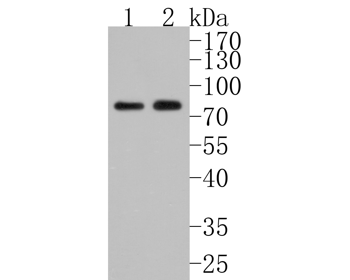 Western blot analysis of ACVR2A on different lysates. Proteins were transferred to a PVDF membrane and blocked with 5% BSA in PBS for 1 hour at room temperature. The primary antibody (HA500084, 1/1,000) was used in 5% BSA at room temperature for 2 hours. Goat Anti-Rabbit IgG - HRP Secondary Antibody (HA1001) at 1:200,000 dilution was used for 1 hour at room temperature.<br />
Positive control: <br />
Lane 1: Mouse testis tissue lysate<br />
Lane 4: Rat testis tissue lysate