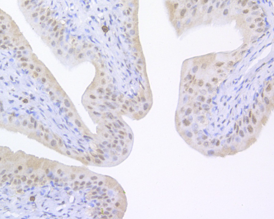 Immunohistochemical analysis of paraffin-embedded rat bladder tissue using anti-UAP56 antibody. The section was pre-treated using heat mediated antigen retrieval with sodium citrate buffer (pH 6.0) for 20 minutes. The tissues were blocked in 5% BSA for 30 minutes at room temperature, washed with ddH2O and PBS, and then probed with the primary antibody (HA500102, 1/400)  for 30 minutes at room temperature. The detection was performed using an HRP conjugated compact polymer system. DAB was used as the chromogen. Tissues were counterstained with hematoxylin and mounted with DPX.