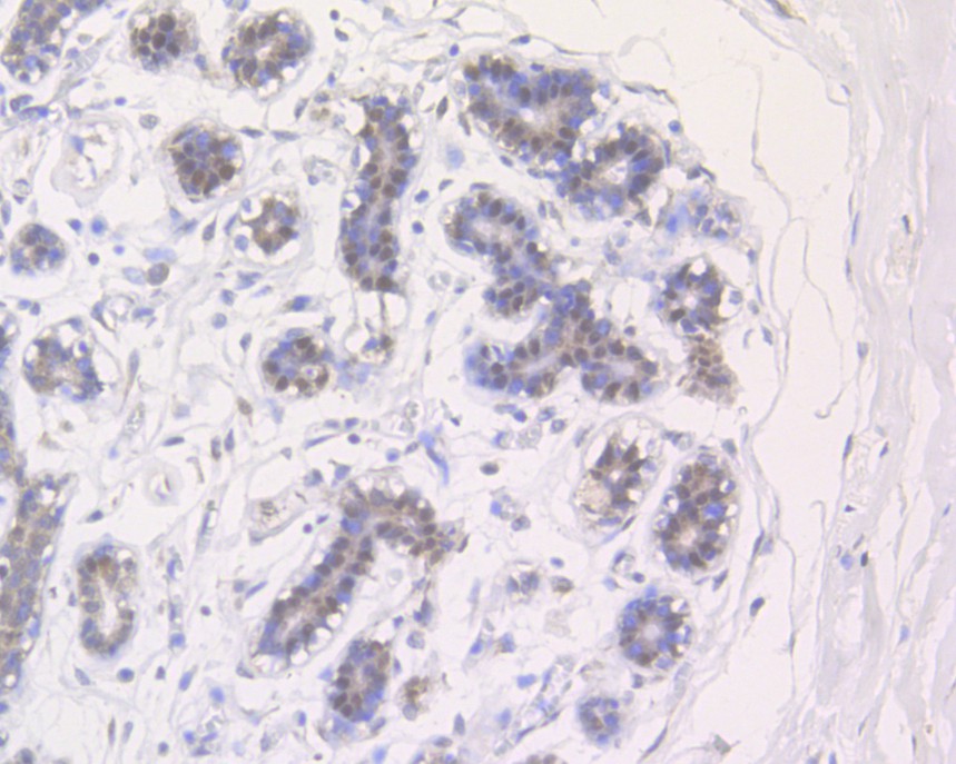 Immunohistochemical analysis of paraffin-embedded human breast tissue using anti-UAP56 antibody. The section was pre-treated using heat mediated antigen retrieval with sodium citrate buffer (pH 6.0) for 20 minutes. The tissues were blocked in 5% BSA for 30 minutes at room temperature, washed with ddH2O and PBS, and then probed with the primary antibody (HA500102, 1/400)  for 30 minutes at room temperature. The detection was performed using an HRP conjugated compact polymer system. DAB was used as the chromogen. Tissues were counterstained with hematoxylin and mounted with DPX.