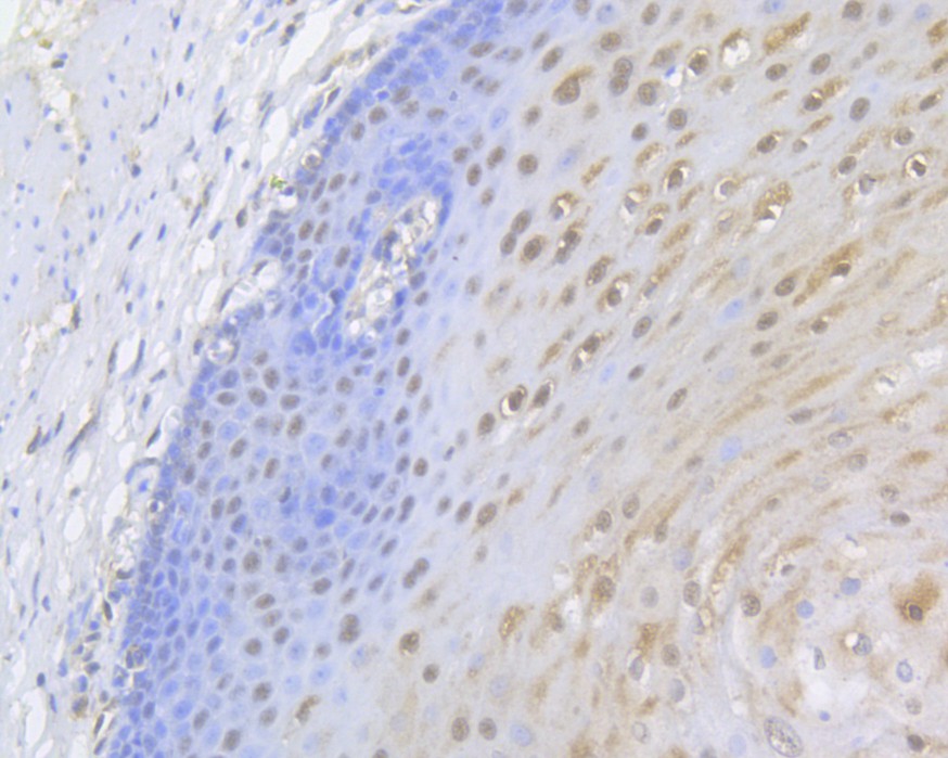 Immunohistochemical analysis of paraffin-embedded human esophagus tissue using anti-UAP56 antibody. The section was pre-treated using heat mediated antigen retrieval with sodium citrate buffer (pH 6.0) for 20 minutes. The tissues were blocked in 5% BSA for 30 minutes at room temperature, washed with ddH2O and PBS, and then probed with the primary antibody (HA500102, 1/400)  for 30 minutes at room temperature. The detection was performed using an HRP conjugated compact polymer system. DAB was used as the chromogen. Tissues were counterstained with hematoxylin and mounted with DPX.