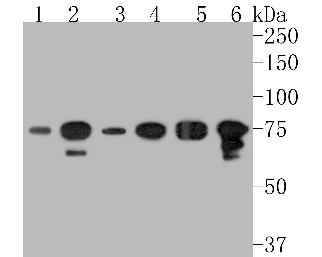 Western blot analysis of DDX3 on different lysates. Proteins were transferred to a PVDF membrane and blocked with 5% BSA in PBS for 1 hour at room temperature. The primary antibody (HA500093, 1/500) was used in 5% BSA at room temperature for 2 hours. Goat Anti-Rabbit IgG - HRP Secondary Antibody (HA1001) at 1:5,000 dilution was used for 1 hour at room temperature.<br />
Positive control: <br />
Lane 1: NIH/3T3 cell lysate<br />
Lane 2: K562 cell lysate<br />
Lane 3: A431 cell lysate<br />
Lane 4: HepG2 cell lysate<br />
Lane 5: Jurkat cell lysate<br />
Lane 6: Rat testis tissue lysate