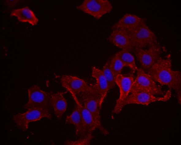 ICC staining of PPP3CC in HepG2 cells (green). Formalin fixed cells were permeabilized with 0.1% Triton X-100 in TBS for 10 minutes at room temperature and blocked with 1% Blocker BSA for 15 minutes at room temperature. Cells were probed with the primary antibody (HA500101, 1/50) for 1 hour at room temperature, washed with PBS. Alexa Fluor®488 Goat anti-Rabbit IgG was used as the secondary antibody at 1/1,000 dilution. The nuclear counter stain is DAPI (blue).