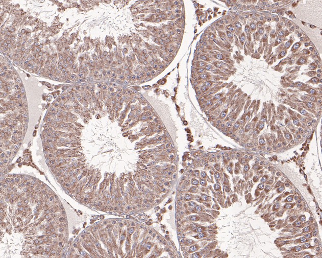 Immunohistochemical analysis of paraffin-embedded mouse testis tissue using anti-PPP3CC antibody. The section was pre-treated using heat mediated antigen retrieval with Tris-EDTA buffer (pH 8.0-8.4) for 20 minutes.The tissues were blocked in 5% BSA for 30 minutes at room temperature, washed with ddH2O and PBS, and then probed with the primary antibody (HA500101, 1/400) for 30 minutes at room temperature. The detection was performed using an HRP conjugated compact polymer system. DAB was used as the chromogen. Tissues were counterstained with hematoxylin and mounted with DPX.