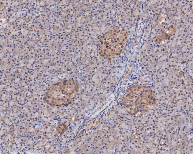 Immunohistochemical analysis of paraffin-embedded human pancreas tissue using anti-MCRS1 antibody. The section was pre-treated using heat mediated antigen retrieval with sodium citrate buffer (pH 6.0) for 20 minutes. The tissues were blocked in 5% BSA for 30 minutes at room temperature, washed with ddH2O and PBS, and then probed with the primary antibody (HA500120, 1/400)  for 30 minutes at room temperature. The detection was performed using an HRP conjugated compact polymer system. DAB was used as the chromogen. Tissues were counterstained with hematoxylin and mounted with DPX.
