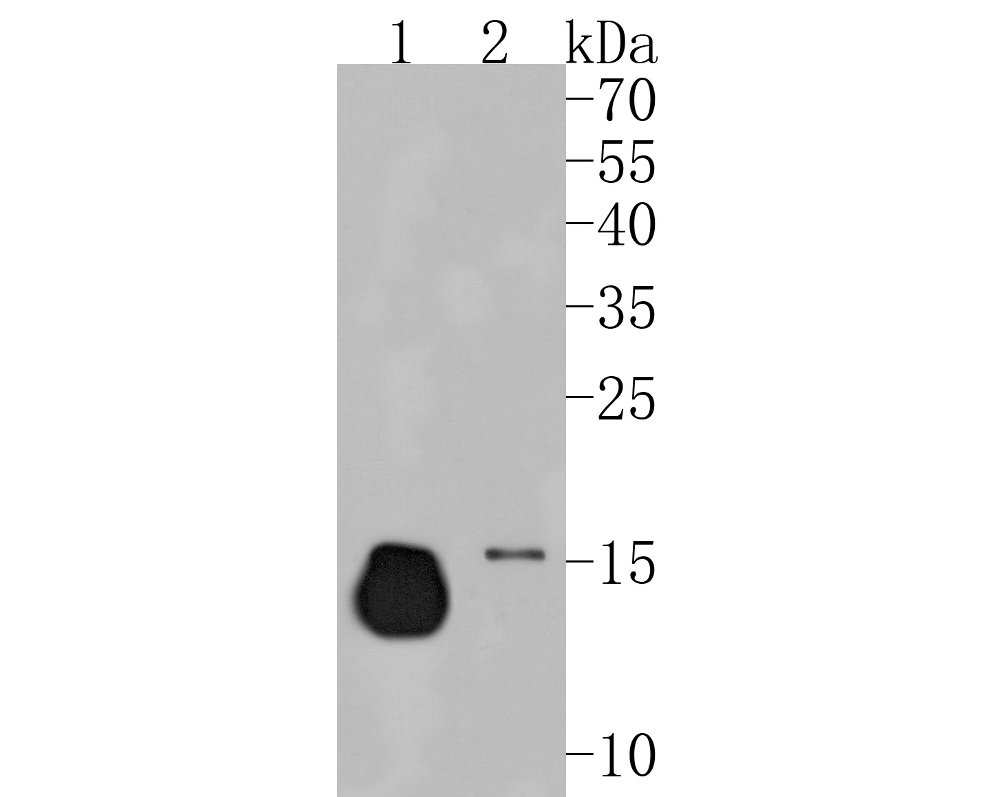 Western blot analysis of Ly6c on different lysates. Proteins were transferred to a PVDF membrane and blocked with 5% BSA in PBS for 1 hour at room temperature. The primary antibody (HA500088, 1/500) was used in 5% BSA at room temperature for 2 hours. Goat Anti-Rabbit IgG - HRP Secondary Antibody (HA1001) at 1:5,000 dilution was used for 1 hour at room temperature.<br />
Positive control: <br />
Lane 1: Mouse lung tissue lysate<br />
Lane 2: Mouse cerebellum tissue lysate