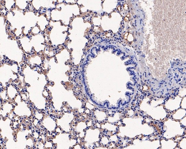 Immunohistochemical analysis of paraffin-embedded mouse lung tissue using anti-Ly6c antibody. The section was pre-treated using heat mediated antigen retrieval with Tris-EDTA buffer (pH 8.0-8.4) for 20 minutes.The tissues were blocked in 5% BSA for 30 minutes at room temperature, washed with ddH2O and PBS, and then probed with the primary antibody (HA500088, 1/400) for 30 minutes at room temperature. The detection was performed using an HRP conjugated compact polymer system. DAB was used as the chromogen. Tissues were counterstained with hematoxylin and mounted with DPX.