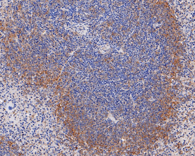 Immunohistochemical analysis of paraffin-embedded mouse spleen tissue using anti-Ly6c antibody. The section was pre-treated using heat mediated antigen retrieval with Tris-EDTA buffer (pH 8.0-8.4) for 20 minutes.The tissues were blocked in 5% BSA for 30 minutes at room temperature, washed with ddH2O and PBS, and then probed with the primary antibody (HA500088, 1/400) for 30 minutes at room temperature. The detection was performed using an HRP conjugated compact polymer system. DAB was used as the chromogen. Tissues were counterstained with hematoxylin and mounted with DPX.