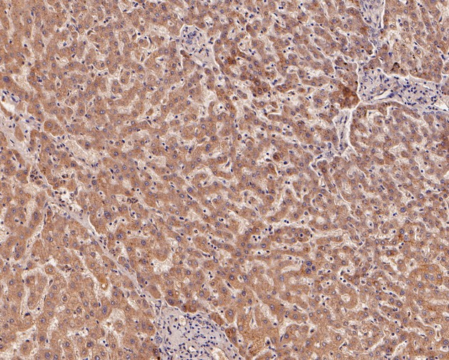 Immunohistochemical analysis of paraffin-embedded human liver tissue using anti-IGF1 (E peptide) antibody. The section was pre-treated using heat mediated antigen retrieval with Tris-EDTA buffer (pH 8.0-8.4) for 20 minutes.The tissues were blocked in 5% BSA for 30 minutes at room temperature, washed with ddH2O and PBS, and then probed with the primary antibody (HA500107, 1/800) for 30 minutes at room temperature. The detection was performed using an HRP conjugated compact polymer system. DAB was used as the chromogen. Tissues were counterstained with hematoxylin and mounted with DPX.