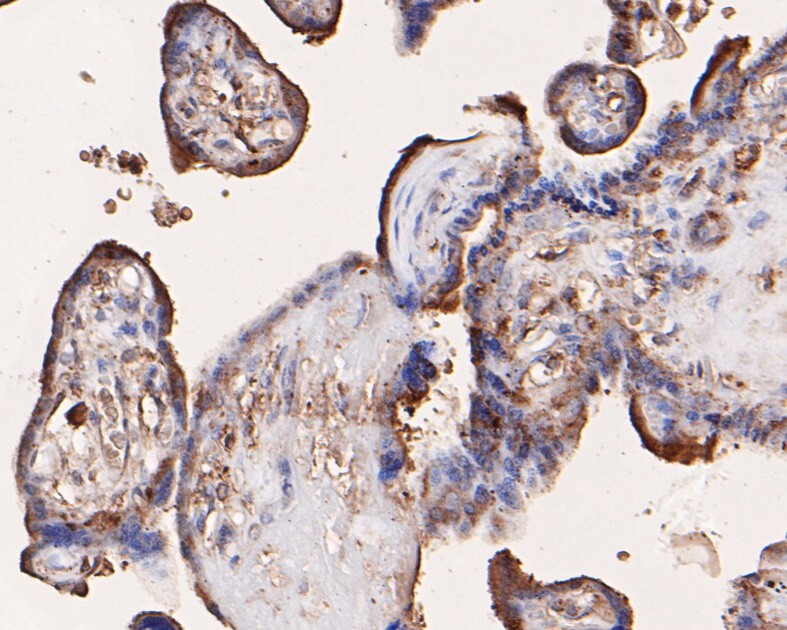 Immunohistochemical analysis of paraffin-embedded human placenta tissue using anti-IREB2 antibody. The section was pre-treated using heat mediated antigen retrieval with Tris-EDTA buffer (pH 8.0-8.4) for 20 minutes.The tissues were blocked in 5% BSA for 30 minutes at room temperature, washed with ddH2O and PBS, and then probed with the primary antibody (HA600015, 1/400) for 30 minutes at room temperature. The detection was performed using an HRP conjugated compact polymer system. DAB was used as the chromogen. Tissues were counterstained with hematoxylin and mounted with DPX.