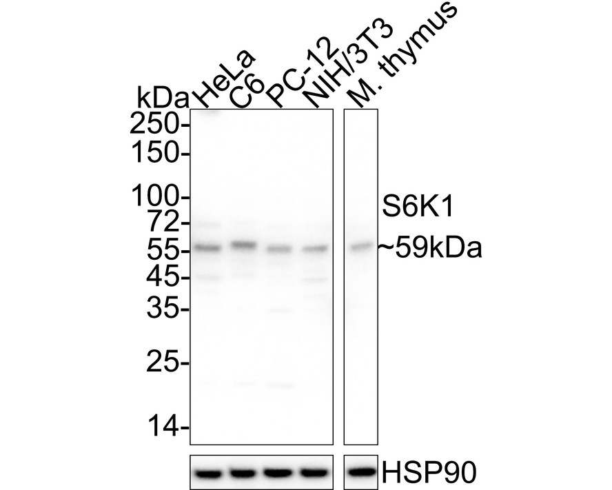 Western blot analysis of S6K1 on different lysates. Proteins were transferred to a PVDF membrane and blocked with 5% BSA in PBS for 1 hour at room temperature. The primary antibody (HA500095, 1/1,000) was used in 5% BSA at room temperature for 2 hours. Goat Anti-Rabbit IgG - HRP Secondary Antibody (HA1001) at 1:200,000 dilution was used for 1 hour at room temperature.<br />
Positive control: <br />
Lane 1: MCF-7 cell lysate<br />
Lane 2: Human brain tissue lysate<br />
Lane 3: Rat cerebellum tissue lysate