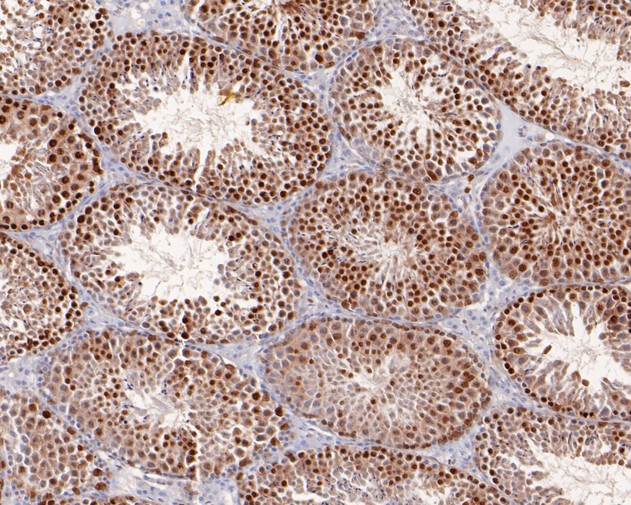 Immunohistochemical analysis of paraffin-embedded mouse testis tissue using anti-S6K1 antibody. The section was pre-treated using heat mediated antigen retrieval with Tris-EDTA buffer (pH 8.0-8.4) for 20 minutes.The tissues were blocked in 5% BSA for 30 minutes at room temperature, washed with ddH2O and PBS, and then probed with the primary antibody (HA500095, 1/400) for 30 minutes at room temperature. The detection was performed using an HRP conjugated compact polymer system. DAB was used as the chromogen. Tissues were counterstained with hematoxylin and mounted with DPX.