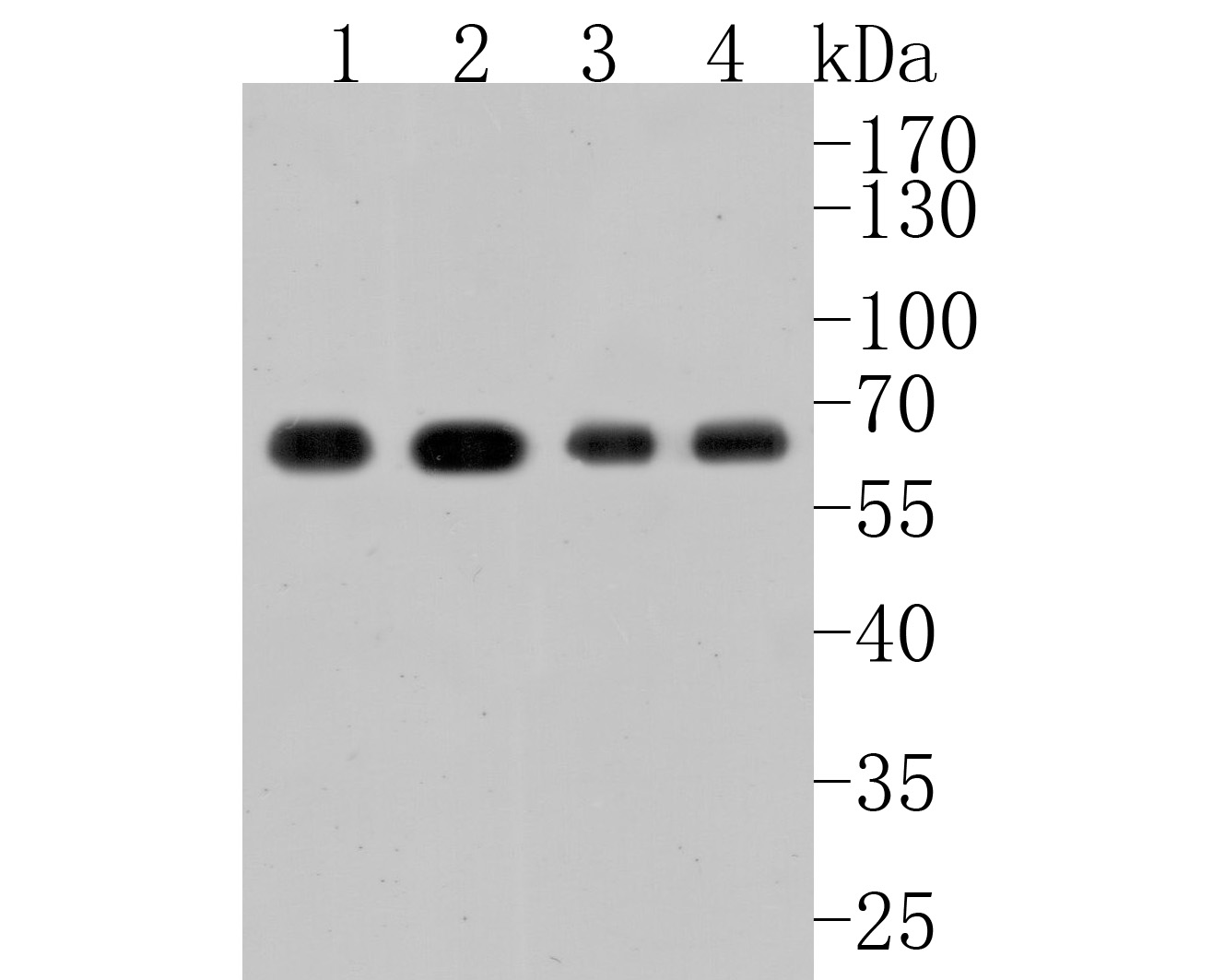 Western blot analysis of ATG14L on different lysates. Proteins were transferred to a PVDF membrane and blocked with 5% BSA in PBS for 1 hour at room temperature. The primary antibody (HA500096, 1/1,000) was used in 5% BSA at room temperature for 2 hours. Goat Anti-Rabbit IgG - HRP Secondary Antibody (HA1001) at 1:200,000 dilution was used for 1 hour at room temperature.<br />
Positive control: <br />
Lane 1: Hela cell lysate<br />
Lane 2: MCF-7 cell lysate<br />
Lane 3: HepG2 cell lysate<br />
Lane 4: SiHa cell lysate