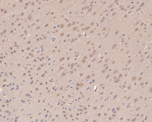 Immunohistochemical analysis of paraffin-embedded rat brain tissue using anti-ATG14L antibody. The section was pre-treated using heat mediated antigen retrieval with Tris-EDTA buffer (pH 8.0-8.4) for 20 minutes.The tissues were blocked in 5% BSA for 30 minutes at room temperature, washed with ddH2O and PBS, and then probed with the primary antibody (HA500096, 1/100) for 30 minutes at room temperature. The detection was performed using an HRP conjugated compact polymer system. DAB was used as the chromogen. Tissues were counterstained with hematoxylin and mounted with DPX.