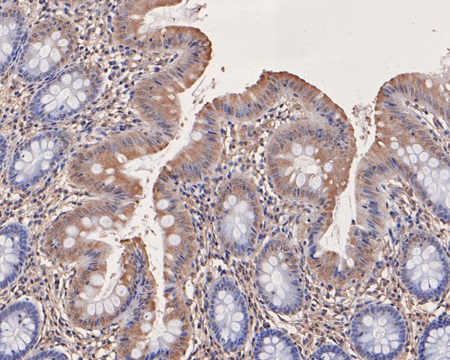 Immunohistochemical analysis of paraffin-embedded human colon tissue using anti-ATG14L antibody. The section was pre-treated using heat mediated antigen retrieval with Tris-EDTA buffer (pH 8.0-8.4) for 20 minutes.The tissues were blocked in 5% BSA for 30 minutes at room temperature, washed with ddH2O and PBS, and then probed with the primary antibody (HA500096, 1/100) for 30 minutes at room temperature. The detection was performed using an HRP conjugated compact polymer system. DAB was used as the chromogen. Tissues were counterstained with hematoxylin and mounted with DPX.