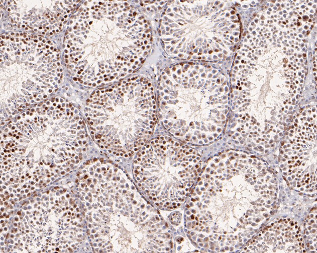 Immunohistochemical analysis of paraffin-embedded mouse testis tissue using anti-ATG14L antibody. The section was pre-treated using heat mediated antigen retrieval with Tris-EDTA buffer (pH 8.0-8.4) for 20 minutes.The tissues were blocked in 5% BSA for 30 minutes at room temperature, washed with ddH2O and PBS, and then probed with the primary antibody (HA500096, 1/400) for 30 minutes at room temperature. The detection was performed using an HRP conjugated compact polymer system. DAB was used as the chromogen. Tissues were counterstained with hematoxylin and mounted with DPX.