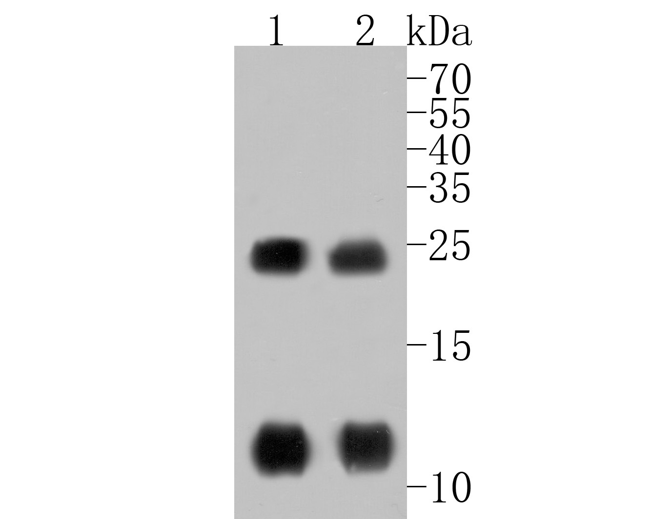 Western blot analysis of Phospholamban on different lysates. Proteins were transferred to a PVDF membrane and blocked with 5% BSA in PBS for 1 hour at room temperature. The primary antibody (HA500103, 1/1,000) was used in 5% BSA at room temperature for 2 hours. Goat Anti-Rabbit IgG - HRP Secondary Antibody (HA1001) at 1:200,000 dilution was used for 1 hour at room temperature.<br />
Positive control: <br />
Lane 1: Rat heart tissue lysate<br />
Lane 2: Human heart tissue lysate
