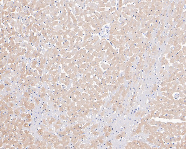 Immunohistochemical analysis of paraffin-embedded rat heart tissue using anti-Phospholamban antibody. The section was pre-treated using heat mediated antigen retrieval with Tris-EDTA buffer (pH 8.0-8.4) for 20 minutes.The tissues were blocked in 5% BSA for 30 minutes at room temperature, washed with ddH2O and PBS, and then probed with the primary antibody (HA500103, 1/400) for 30 minutes at room temperature. The detection was performed using an HRP conjugated compact polymer system. DAB was used as the chromogen. Tissues were counterstained with hematoxylin and mounted with DPX.