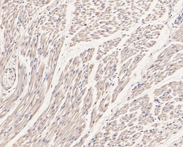 Immunohistochemical analysis of paraffin-embedded human fetal skeletal muscle tissue using anti-Phospholamban antibody. The section was pre-treated using heat mediated antigen retrieval with Tris-EDTA buffer (pH 8.0-8.4) for 20 minutes.The tissues were blocked in 5% BSA for 30 minutes at room temperature, washed with ddH2O and PBS, and then probed with the primary antibody (HA500103, 1/400) for 30 minutes at room temperature. The detection was performed using an HRP conjugated compact polymer system. DAB was used as the chromogen. Tissues were counterstained with hematoxylin and mounted with DPX.