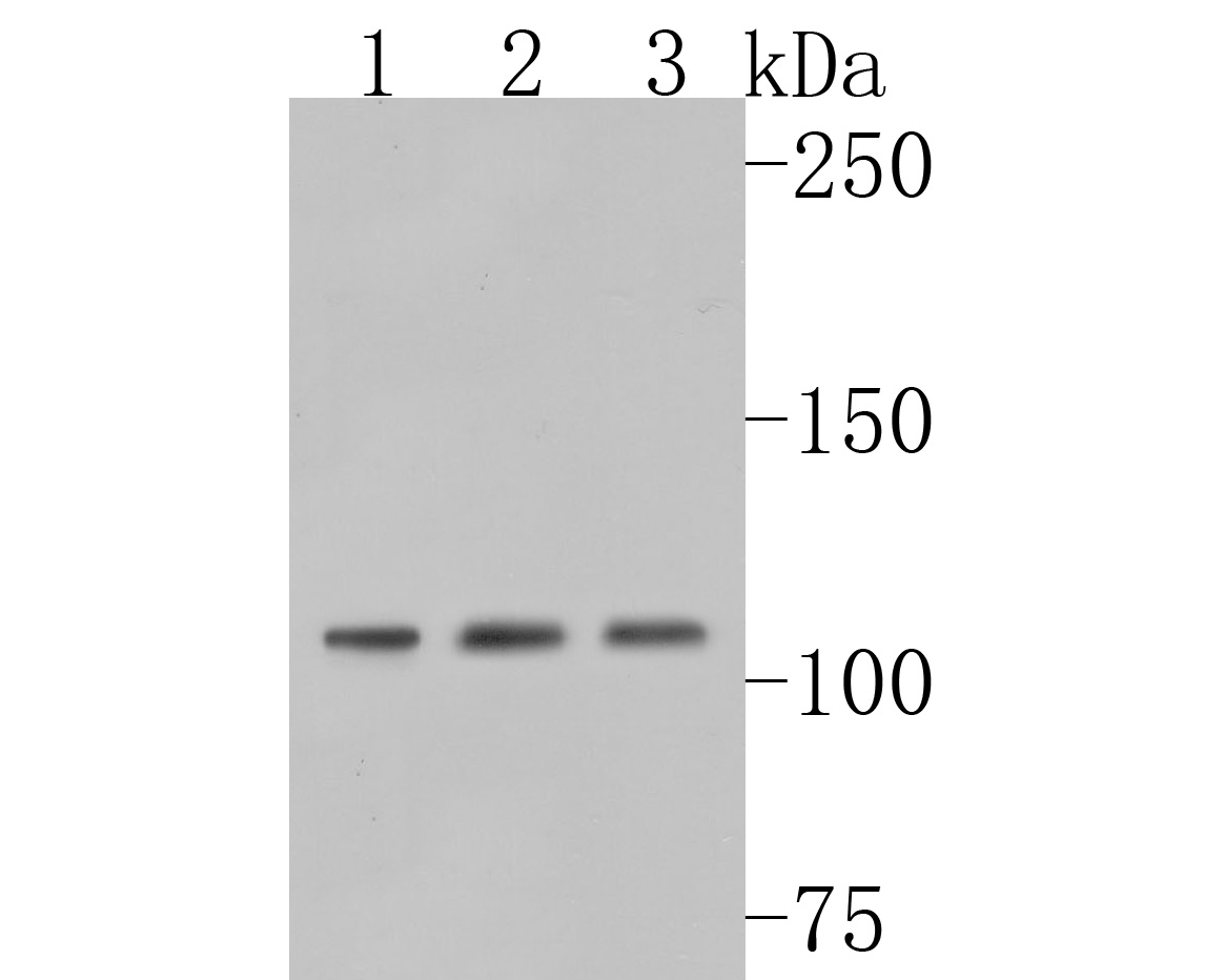 Western blot analysis of NR3B on different lysates. Proteins were transferred to a PVDF membrane and blocked with 5% BSA in PBS for 1 hour at room temperature. The primary antibody (HA500079, 1/1,000) was used in 5% BSA at room temperature for 2 hours. Goat Anti-Rabbit IgG - HRP Secondary Antibody (HA1001) at 1:200,000 dilution was used for 1 hour at room temperature.<br />
Positive control: <br />
Lane 1: THP-1 cell lysate<br />
Lane 2: 293 cell lysate<br />
Lane 2: Daudi cell lysate