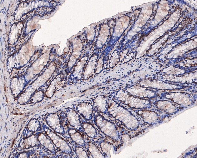 Immunohistochemical analysis of paraffin-embedded rat large intestine tissue using anti-PPP1CA antibody. The section was pre-treated using heat mediated antigen retrieval with sodium citrate buffer (pH 6.0) for 20 minutes. The tissues were blocked in 5% BSA for 30 minutes at room temperature, washed with ddH2O and PBS, and then probed with the primary antibody (HA500074, 1/100)  for 30 minutes at room temperature. The detection was performed using an HRP conjugated compact polymer system. DAB was used as the chromogen. Tissues were counterstained with hematoxylin and mounted with DPX.
