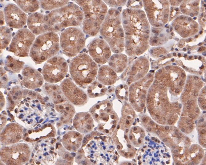 Immunohistochemical analysis of paraffin-embedded mouse kidney tissue using anti-PPP1CA antibody. The section was pre-treated using heat mediated antigen retrieval with sodium citrate buffer (pH 6.0) for 20 minutes. The tissues were blocked in 5% BSA for 30 minutes at room temperature, washed with ddH2O and PBS, and then probed with the primary antibody (HA500074, 1/200)  for 30 minutes at room temperature. The detection was performed using an HRP conjugated compact polymer system. DAB was used as the chromogen. Tissues were counterstained with hematoxylin and mounted with DPX.