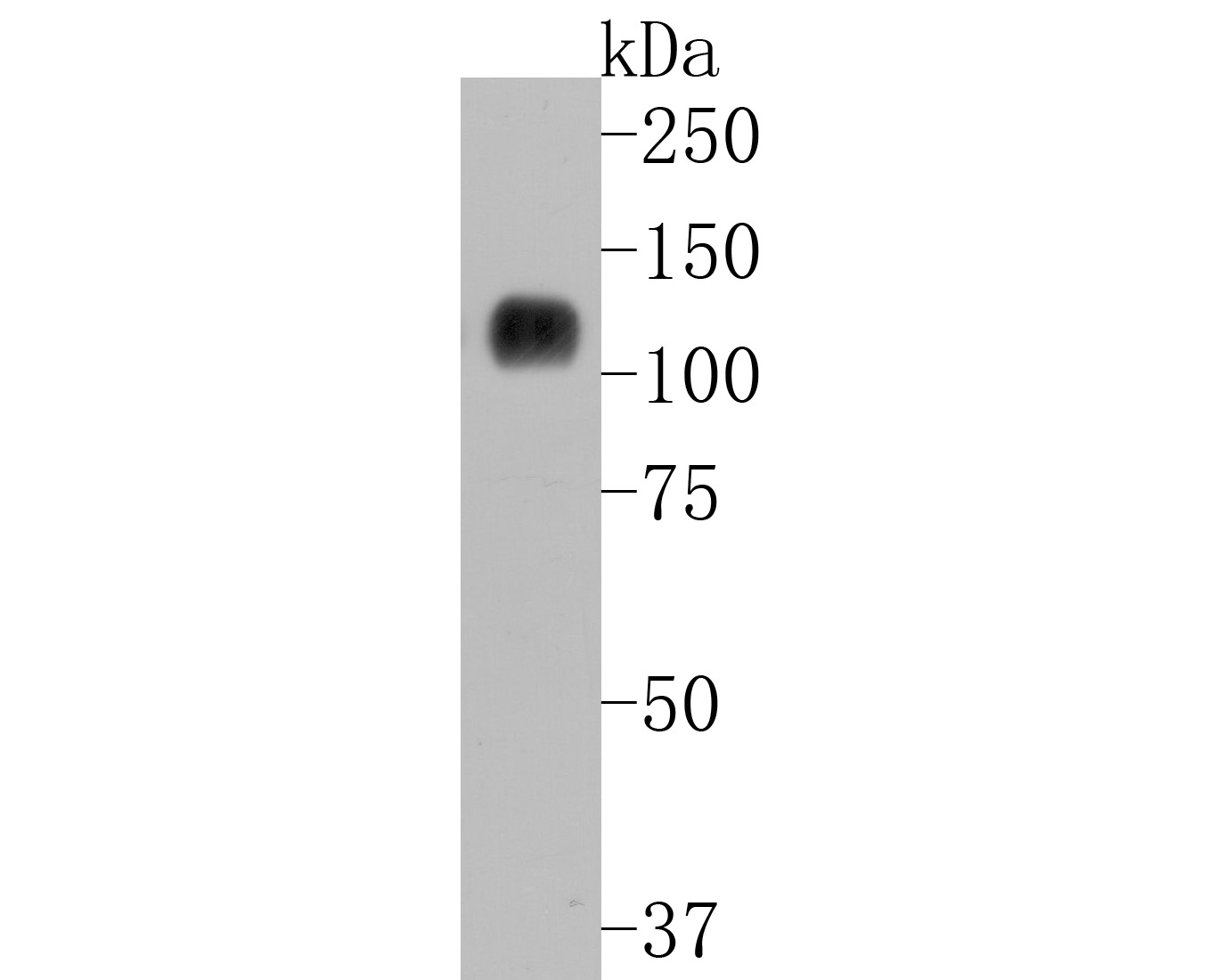 Western blot analysis of His-tag on N-terminal His-tagged recombinant protein lysates. Proteins were transferred to a PVDF membrane and blocked with 5% BSA in PBS for 1 hour at room temperature. The primary antibody (HA600028, 1/10,000) was used in 5% BSA at room temperature for 2 hours. Goat Anti-Mouse IgG - HRP Secondary Antibody (HA1006) at 1:20,000 dilution was used for 1 hour at room temperature.