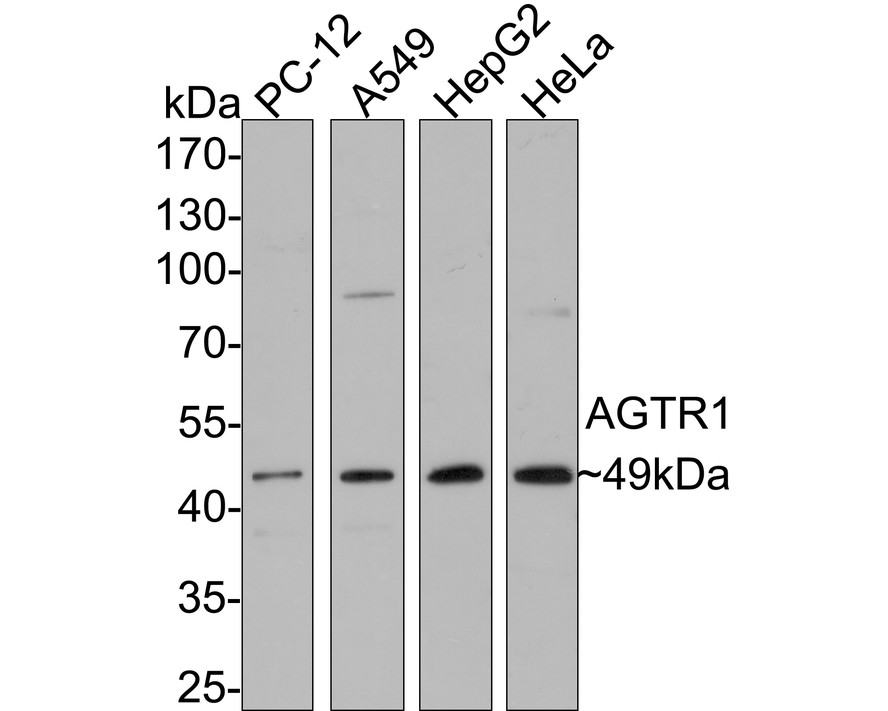 Western blot analysis of Angiotensin II Type 1 Receptor on different lysates with Mouse anti-Angiotensin II Type 1 Receptor antibody (HA600029) at 1/500 dilution.<br />
<br />
Lane 1: PC-12 cell lysate<br />
Lane 2: A549 cell lysate<br />
Lane 3: HepG2 cell lysate<br />
Lane 4: HeLa cell lysate<br />
<br />
Lysates/proteins at 10 µg/Lane.<br />
<br />
Predicted band size: 41 kDa<br />
Observed band size: 49 kDa<br />
<br />
Exposure time: 2 minutes;<br />
<br />
10% SDS-PAGE gel.<br />
<br />
Proteins were transferred to a PVDF membrane and blocked with 5% NFDM/TBST for 1 hour at room temperature. The primary antibody (HA600029) at 1/500 dilution was used in 5% NFDM/TBST at room temperature for 2 hours. Goat Anti-Mouse IgG - HRP Secondary Antibody (HA1006) at 1/200,000 dilution was used for 1 hour at room temperature.