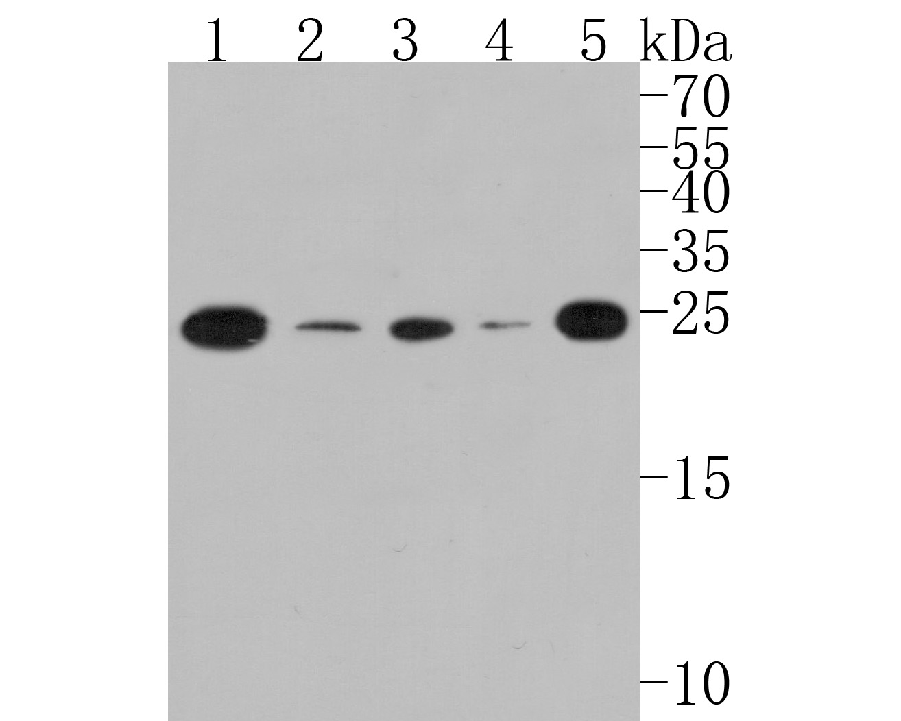 Western blot analysis of TCF21 on different lysates. Proteins were transferred to a PVDF membrane and blocked with 5% BSA in PBS for 1 hour at room temperature. The primary antibody (HA500114, 1/1,000) was used in 5% BSA at room temperature for 2 hours. Goat Anti-Rabbit IgG - HRP Secondary Antibody (HA1001) at 1:200,000 dilution was used for 1 hour at room temperature.<br />
Positive control: <br />
Lane 1: 293T cell lysate<br />
Lane 2: K562 cell lysate<br />
Lane 3: Hela cell lysate<br />
Lane 4: Human lung tissue lysate<br />
Lane 5: Mouse kidney tissue lysate
