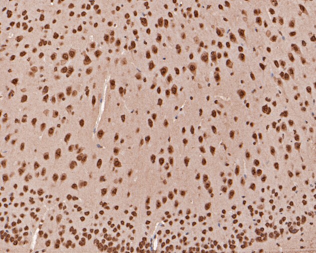 Immunohistochemical analysis of paraffin-embedded mouse brain tissue using anti-TCF21 antibody. The section was pre-treated using heat mediated antigen retrieval with sodium citrate buffer (pH 6.0) for 20 minutes. The tissues were blocked in 5% BSA for 30 minutes at room temperature, washed with ddH2O and PBS, and then probed with the primary antibody (HA500114, 1/400)  for 30 minutes at room temperature. The detection was performed using an HRP conjugated compact polymer system. DAB was used as the chromogen. Tissues were counterstained with hematoxylin and mounted with DPX.