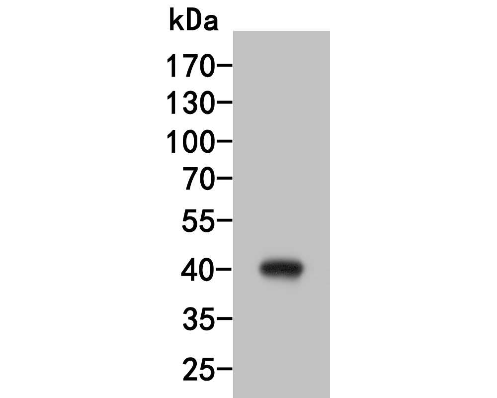 Western blot analysis of HSD3B1 on human placenta tissue lysate. Proteins were transferred to a PVDF membrane and blocked with 5% BSA in PBS for 1 hour at room temperature. The primary antibody (HA500082, 1/5,000) was used in 5% BSA at room temperature for 2 hours. Goat Anti-Rabbit IgG - HRP Secondary Antibody (HA1001) at 1:200,000 dilution was used for 1 hour at room temperature.