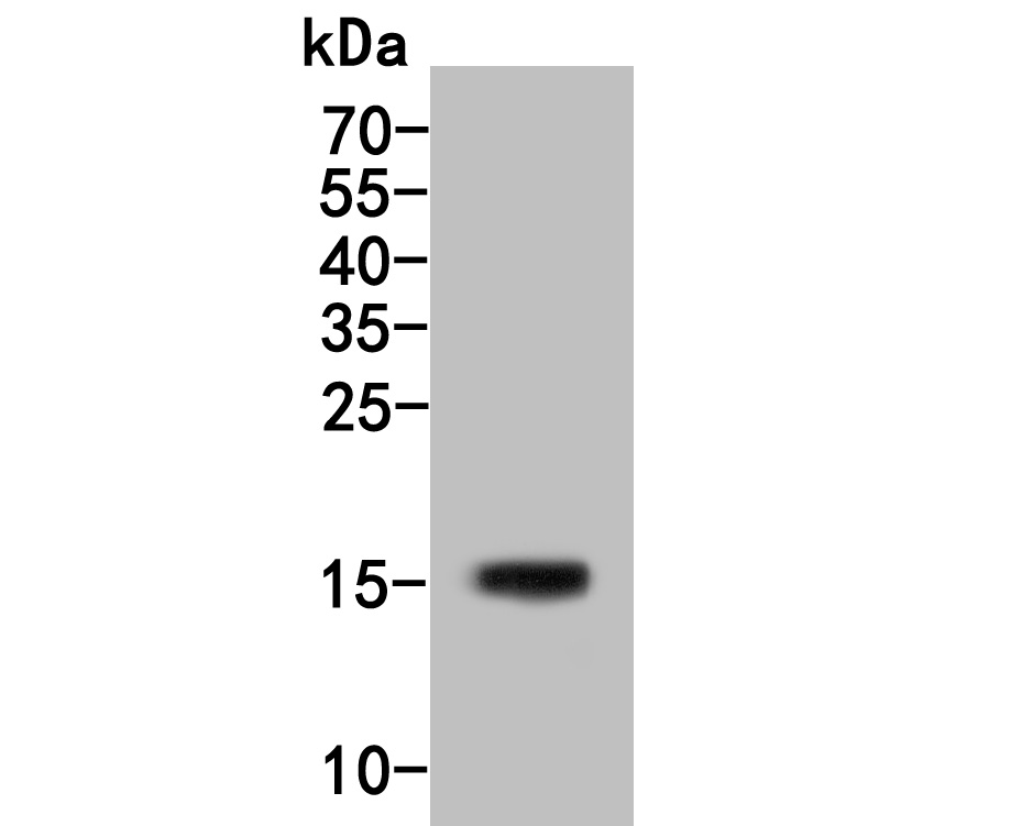 Western blot analysis of IL-5 on LOVO cell lysate. Proteins were transferred to a PVDF membrane and blocked with 5% BSA in PBS for 1 hour at room temperature. The primary antibody (HA500081, 1/500) was used in 5% BSA at room temperature for 2 hours. Goat Anti-Rabbit IgG - HRP Secondary Antibody (HA1001) at 1:5,000 dilution was used for 1 hour at room temperature.
