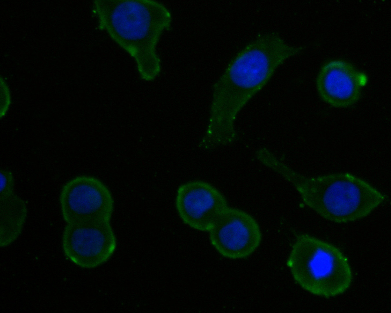 ICC staining of IL-5 in LOVO cells (green). Formalin fixed cells were permeabilized with 0.1% Triton X-100 in TBS for 10 minutes at room temperature and blocked with 1% Blocker BSA for 15 minutes at room temperature. Cells were probed with the primary antibody (HA500081, 1/200) for 1 hour at room temperature, washed with PBS. Alexa Fluor®488 Goat anti-Rabbit IgG was used as the secondary antibody at 1/1,000 dilution. The nuclear counter stain is DAPI (blue).