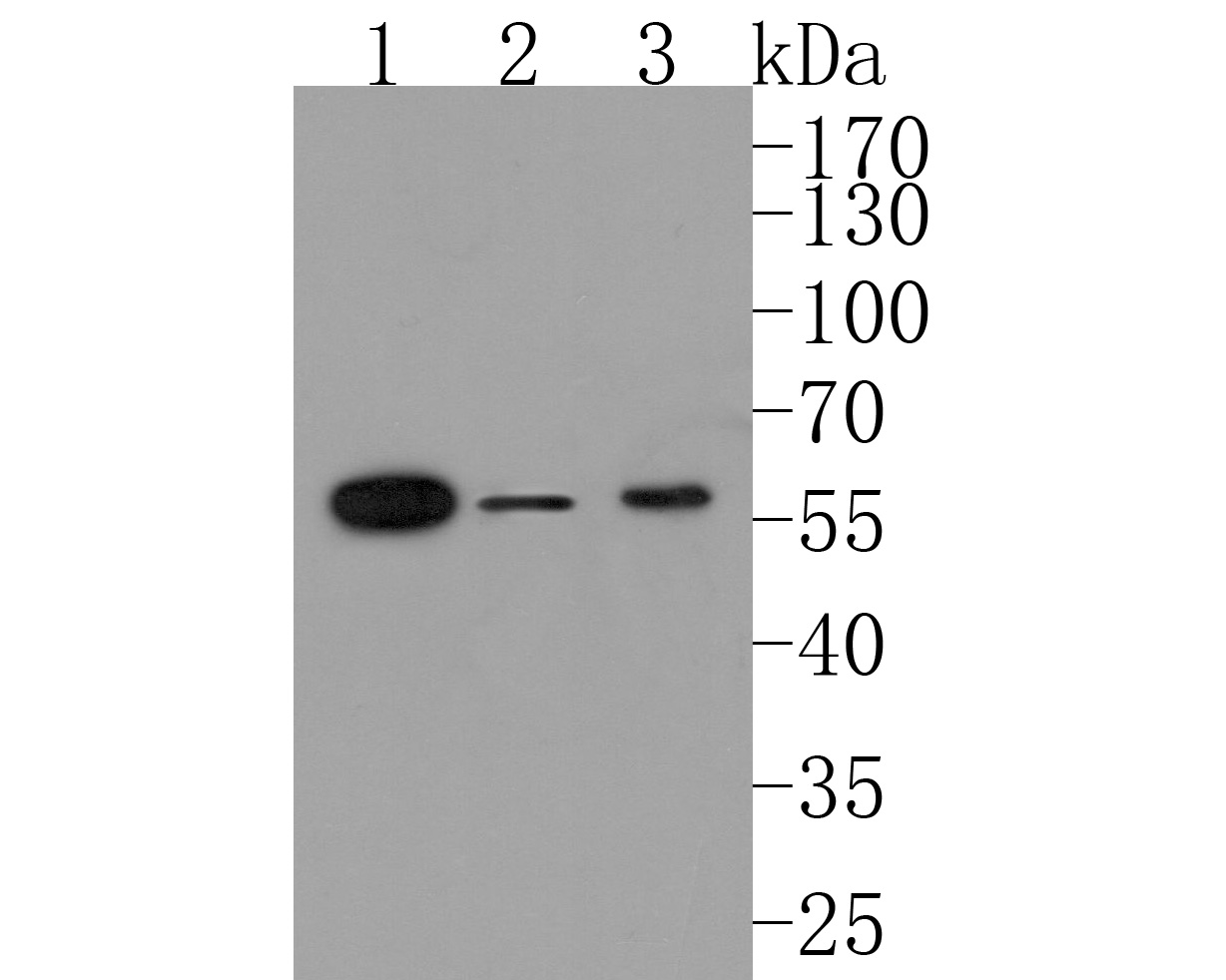 Western blot analysis of Activin Receptor Type IA on different lysates. Proteins were transferred to a PVDF membrane and blocked with 5% BSA in PBS for 1 hour at room temperature. The primary antibody (HA500117, 1/500) was used in 5% BSA at room temperature for 2 hours. Goat Anti-Rabbit IgG - HRP Secondary Antibody (HA1001) at 1:200,000 dilution was used for 1 hour at room temperature.<br />
Positive control: <br />
Lane 1: Mouse skeletal muscle tissue lysate<br />
Lane 2: PC-3 cell lysate<br />
Lane 3: Rat skeletal muscle tissue lysate