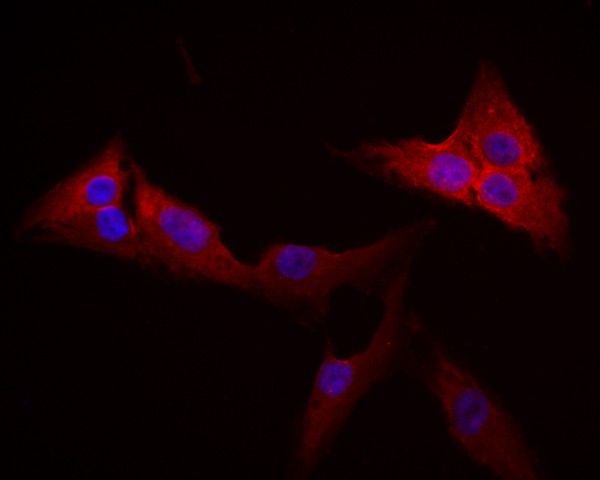 ICC staining of Activin Receptor Type IA in MG-63 cells (red). Formalin fixed cells were permeabilized with 0.1% Triton X-100 in TBS for 10 minutes at room temperature and blocked with 1% Blocker BSA for 15 minutes at room temperature. Cells were probed with the primary antibody (HA500117, 1/50) for 1 hour at room temperature, washed with PBS. Alexa Fluor®594 Goat anti-Rabbit IgG was used as the secondary antibody at 1/1,000 dilution. The nuclear counter stain is DAPI (blue).