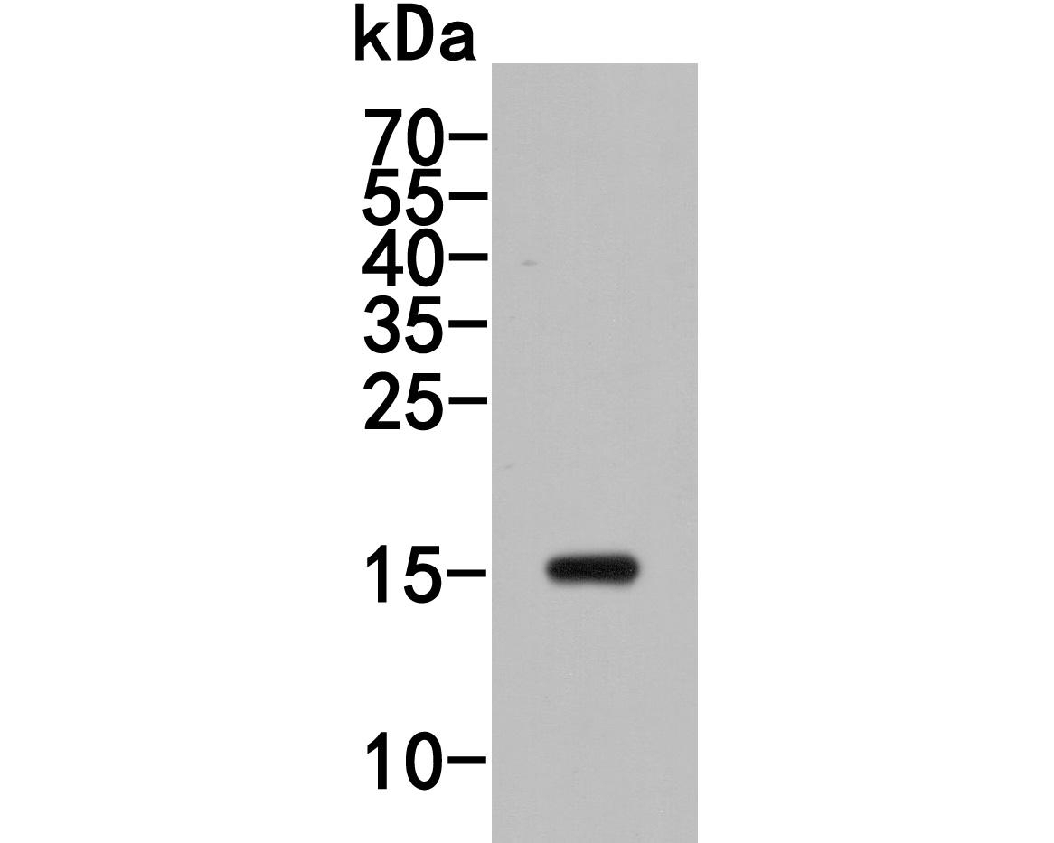 Western blot analysis of p16INK4a on Hela cell lysate. Proteins were transferred to a PVDF membrane and blocked with 5% BSA in PBS for 1 hour at room temperature. The primary antibody (HA600027, 1/500) was used in 5% BSA at room temperature for 2 hours. Goat Anti-Mouse IgG - HRP Secondary Antibody (HA1006) at 1:5,000 dilution was used for 1 hour at room temperature.